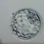 5日後胚盤胞な息子( 4AA)