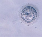 初期胚盤胞