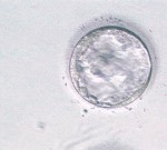 拡張胚盤胞(4CC)